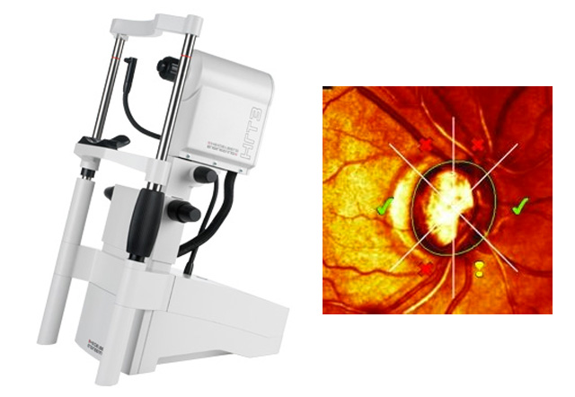 Heidelberg Retina Tomograph